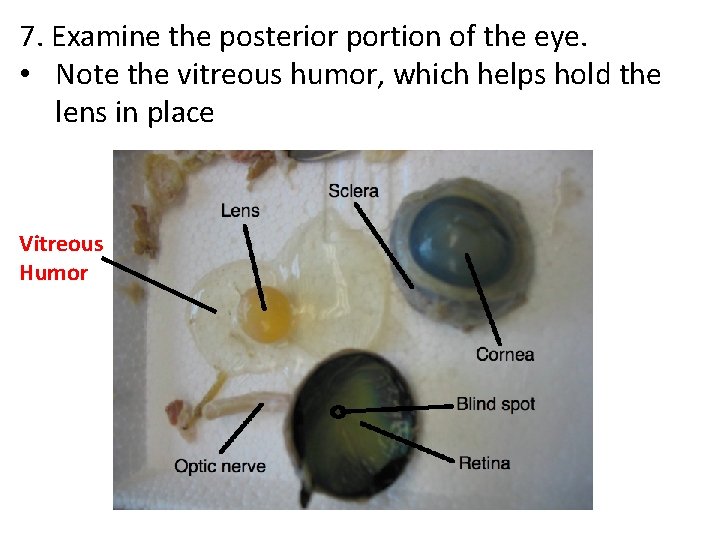 7. Examine the posterior portion of the eye. • Note the vitreous humor, which