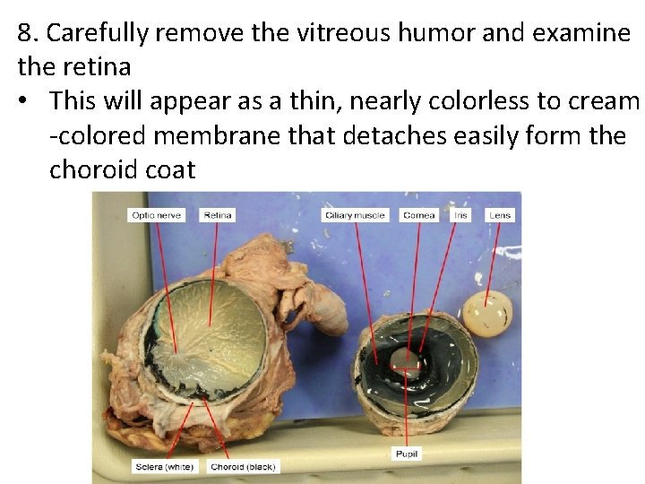 8. Carefully remove the vitreous humor and examine the retina • This will appear
