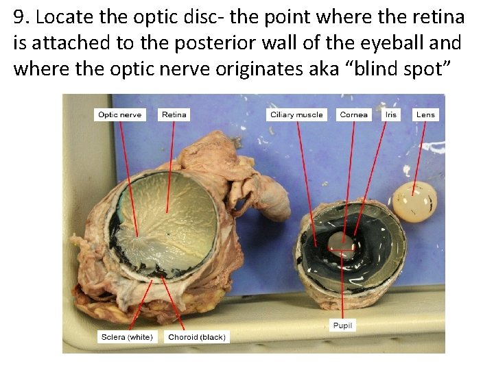 9. Locate the optic disc- the point where the retina is attached to the