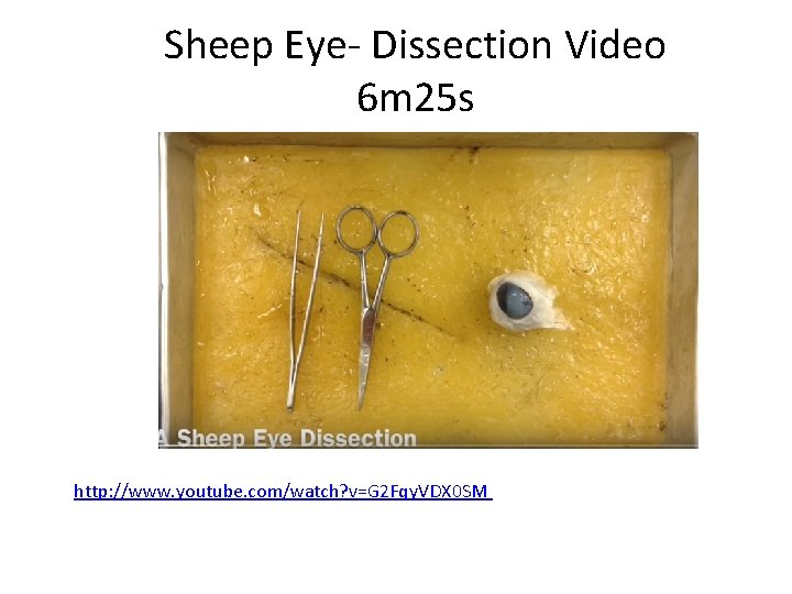 Sheep Eye- Dissection Video 6 m 25 s http: //www. youtube. com/watch? v=G 2