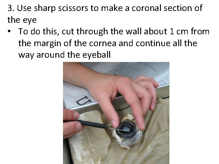 3. Use sharp scissors to make a coronal section of the eye • To