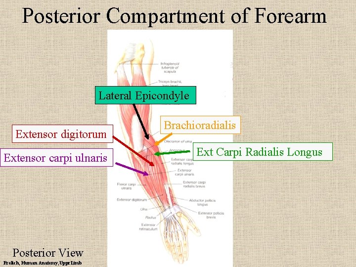 Posterior Compartment of Forearm Lateral Epicondyle Extensor digitorum Extensor carpi ulnaris Posterior View Frolich,
