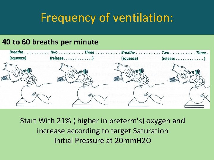 Frequency of ventilation: 40 to 60 breaths per minute Start With 21% ( higher