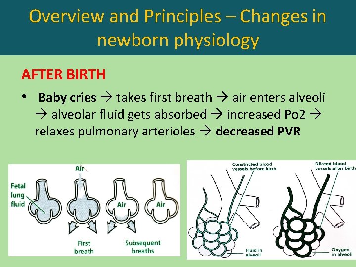 Overview and Principles – Changes in newborn physiology AFTER BIRTH • Baby cries takes