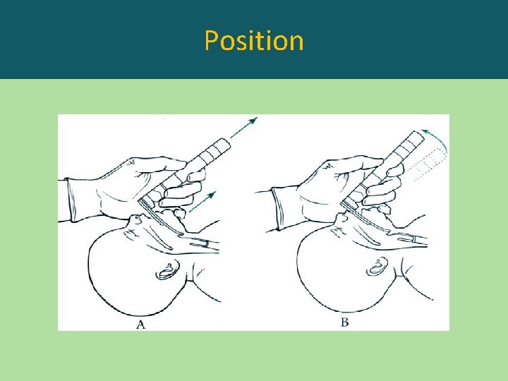 Position 