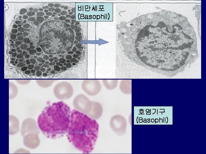 비만세포 (Basophil) 호염기구 (Basophil) 