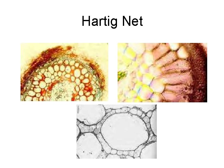 Hartig Net 