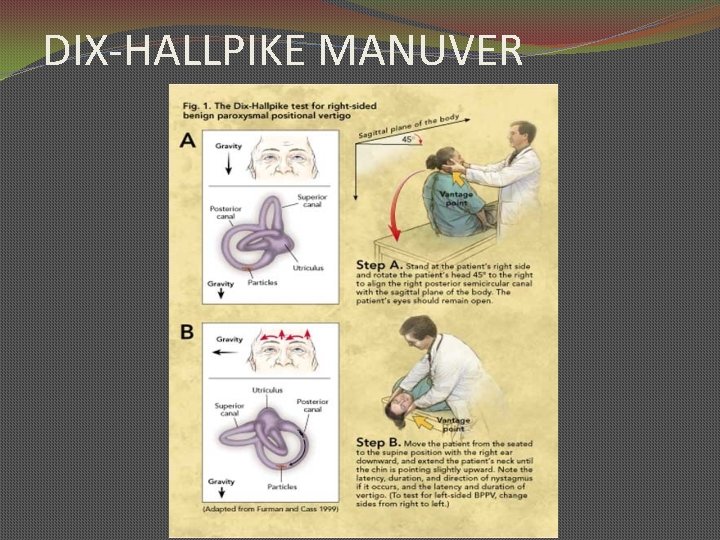 DIX-HALLPIKE MANUVER 