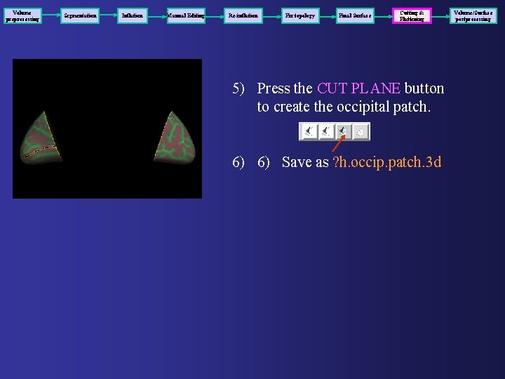 Volume preprocessing Segmentation Inflation Manual Editing Re-inflation Fix topology Final Surface Cutting & Flattening