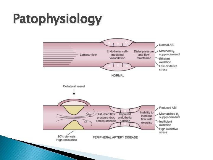 Patophysiology 