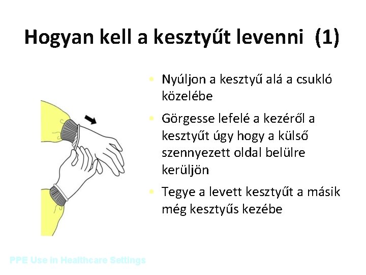 Hogyan kell a kesztyűt levenni (1) • Nyúljon a kesztyű alá a csukló közelébe