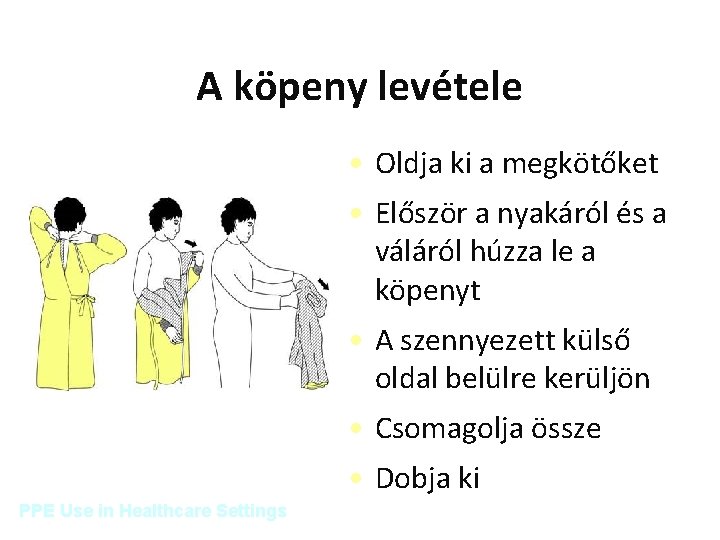 A köpeny levétele • Oldja ki a megkötőket • Először a nyakáról és a