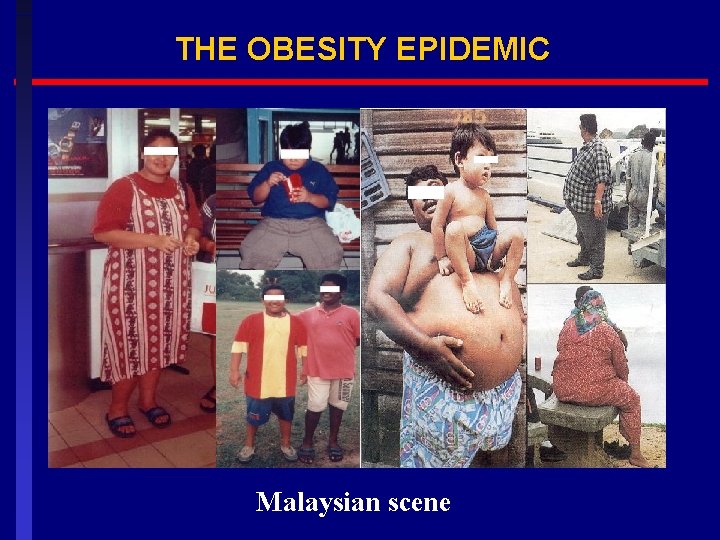 THE OBESITY EPIDEMIC Malaysian scene 