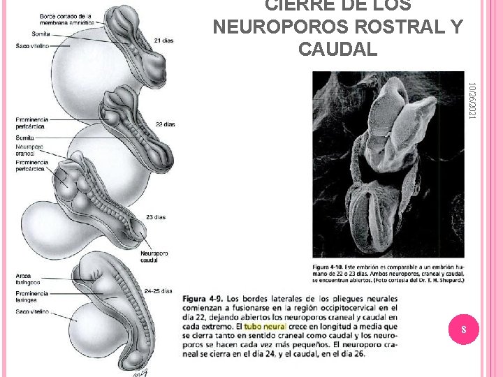 CIERRE DE LOS NEUROPOROS ROSTRAL Y CAUDAL 10/26/2021 8 