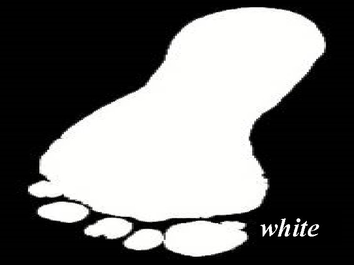 white 