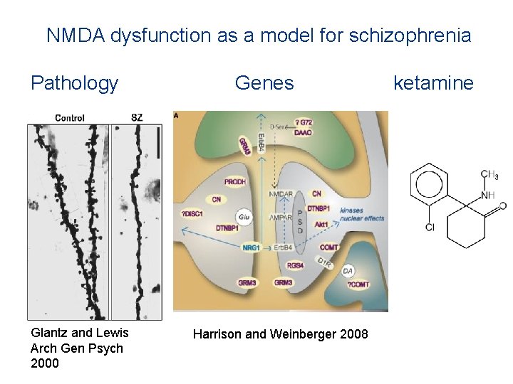 NMDA dysfunction as a model for schizophrenia Pathology Glantz and Lewis Arch Gen Psych