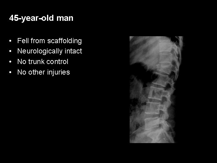 45 -year-old man • • Fell from scaffolding Neurologically intact No trunk control No