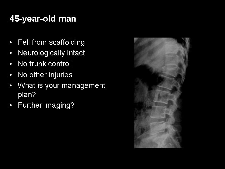 45 -year-old man • • • Fell from scaffolding Neurologically intact No trunk control