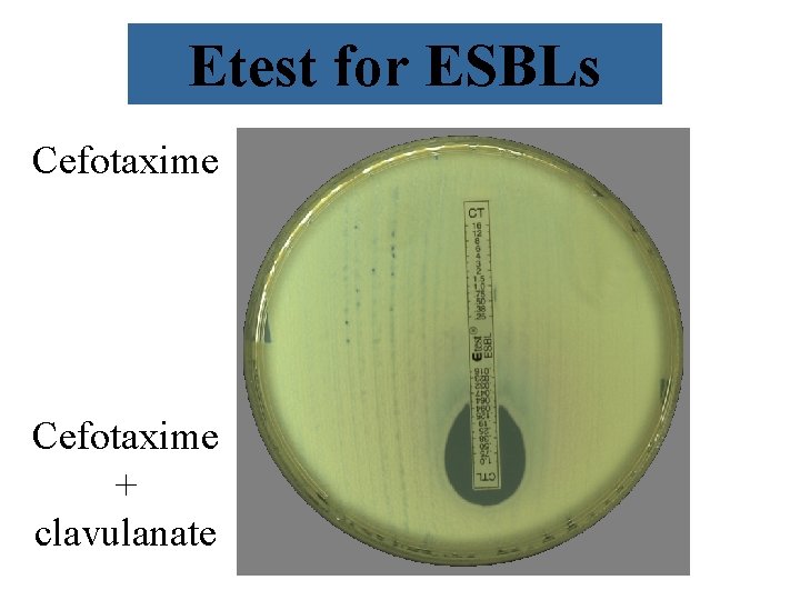 Etest for ESBLs Cefotaxime + clavulanate 