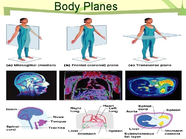 Body Planes Figure 1. 6 