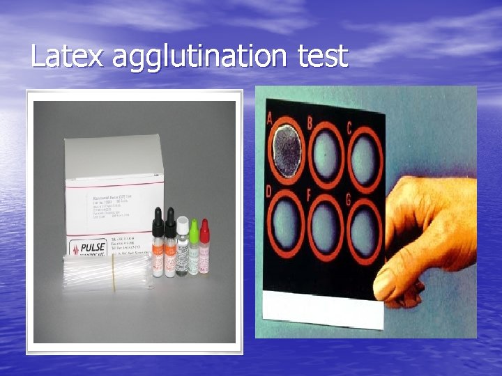 Latex agglutination test 