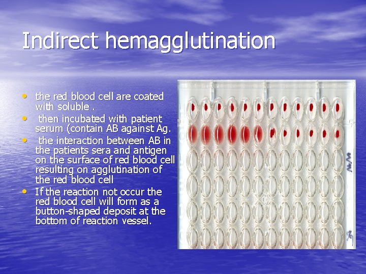Indirect hemagglutination • the red blood cell are coated • • • with soluble.