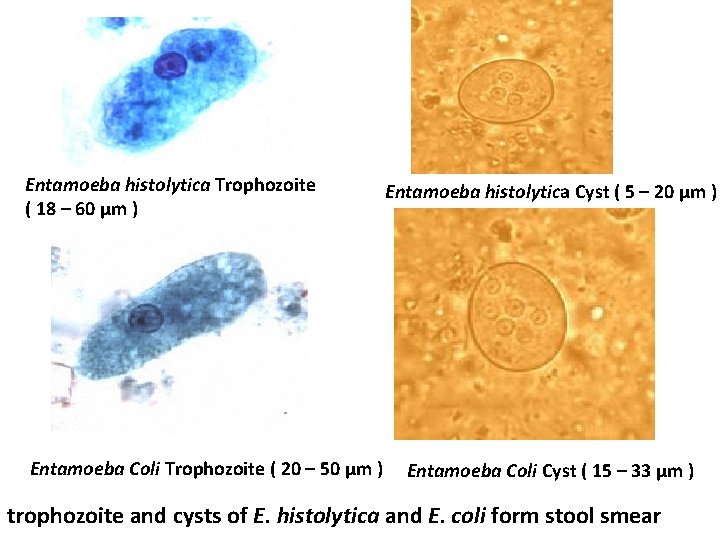 Entamoeba histolytica Trophozoite ( 18 – 60 µm ) Entamoeba Coli Trophozoite ( 20