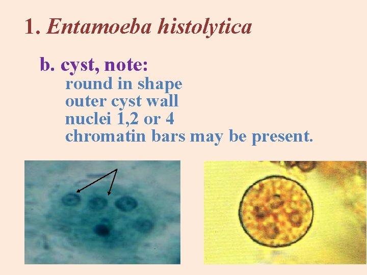1. Entamoeba histolytica b. cyst, note: round in shape outer cyst wall nuclei 1,