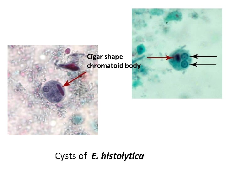 Cigar shape chromatoid body Cysts of E. histolytica 