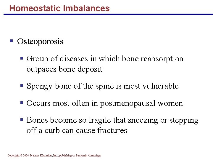 Homeostatic Imbalances § Osteoporosis § Group of diseases in which bone reabsorption outpaces bone