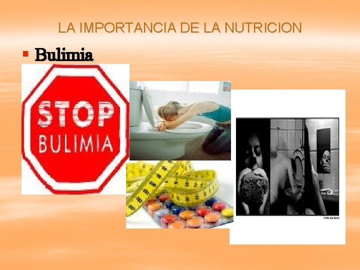 LA IMPORTANCIA DE LA NUTRICION § Bulimia 