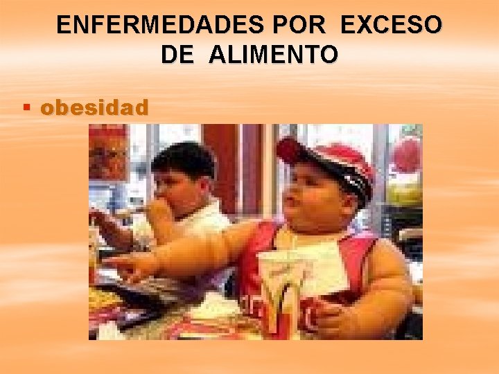 ENFERMEDADES POR EXCESO DE ALIMENTO § obesidad 