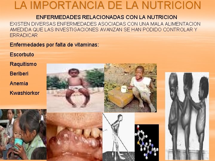 LA IMPORTANCIA DE LA NUTRICION ENFERMEDADES RELACIONADAS CON LA NUTRICION EXISTEN DIVERSAS ENFERMEDADES ASOCIADAS