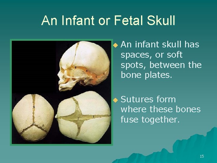 An Infant or Fetal Skull u u An infant skull has spaces, or soft