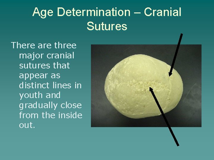 Age Determination – Cranial Sutures There are three major cranial sutures that appear as