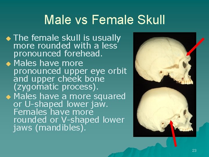 Male vs Female Skull The female skull is usually more rounded with a less