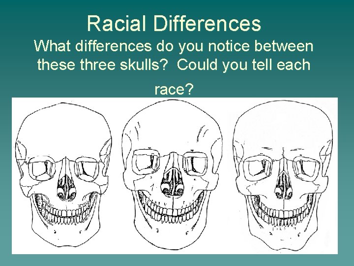 Racial Differences What differences do you notice between these three skulls? Could you tell