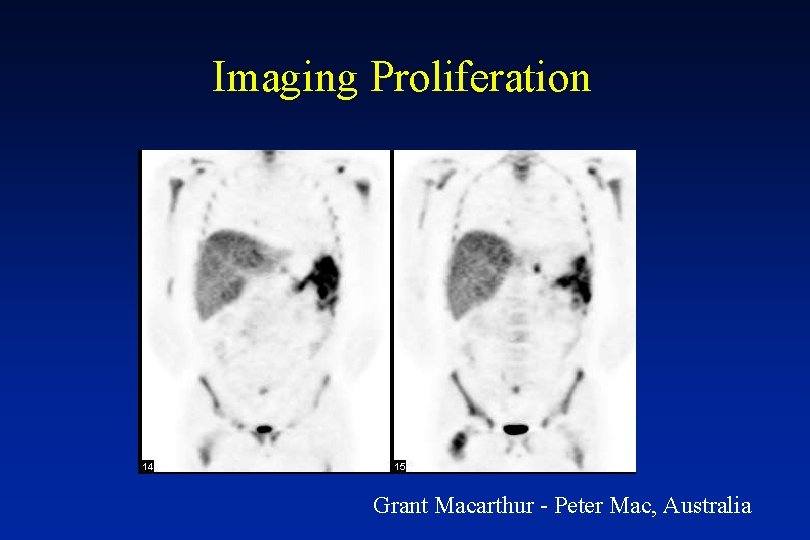 Imaging Proliferation Grant Macarthur - Peter Mac, Australia 