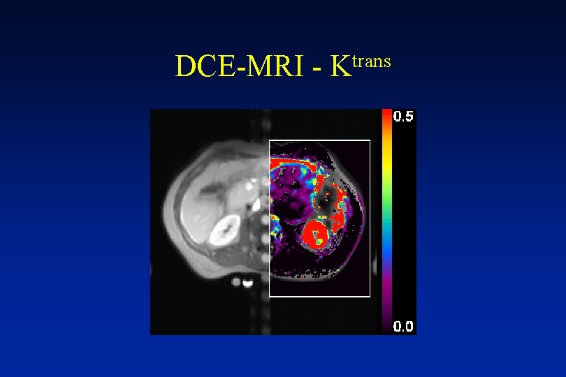 DCE-MRI - trans K 