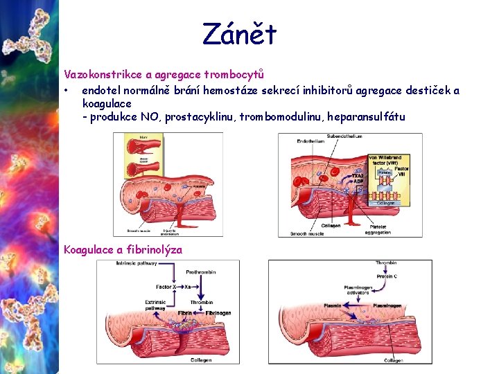 Zánět Vazokonstrikce a agregace trombocytů • endotel normálně brání hemostáze sekrecí inhibitorů agregace destiček