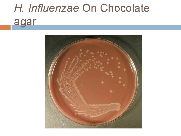 H. Influenzae On Chocolate agar 