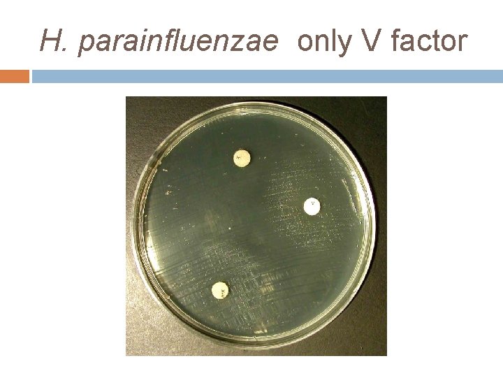 H. parainfluenzae only V factor 