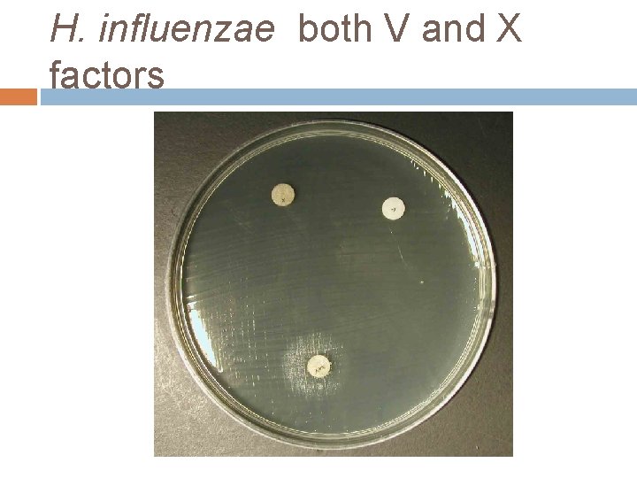 H. influenzae both V and X factors 