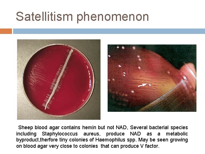 Satellitism phenomenon Sheep blood agar contains hemin but not NAD, Several bacterial species including