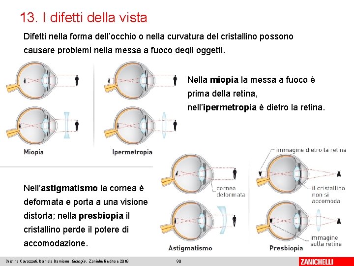 13. I difetti della vista Difetti nella forma dell’occhio o nella curvatura del cristallino