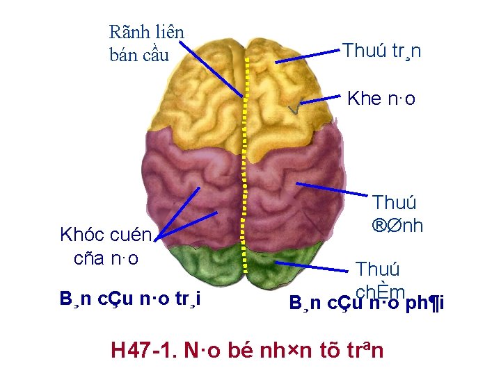 Rãnh liên bán cầu Thuú tr¸n Khe n·o Khóc cuén cña n·o B¸n cÇu