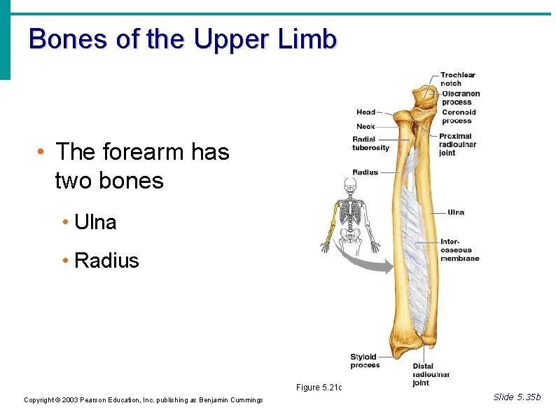 Bones of the Upper Limb • The forearm has two bones • Ulna • Bones of the Upper Limb • The forearm has two bones • Ulna •