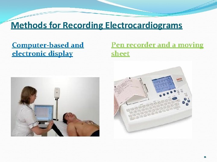 Methods for Recording Electrocardiograms Computer-based and electronic display Pen recorder and a moving sheet