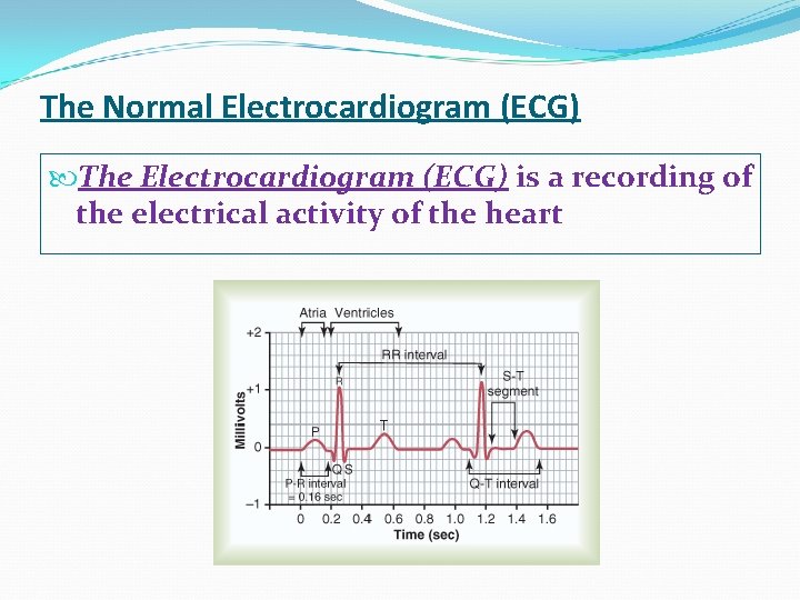 The Normal Electrocardiogram (ECG) The Electrocardiogram (ECG) is a recording of the electrical activity