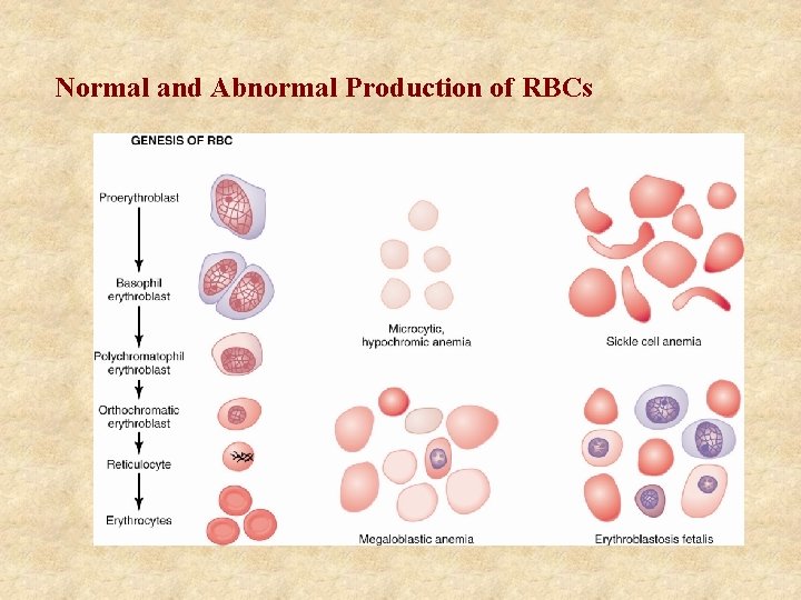 Normal and Abnormal Production of RBCs 